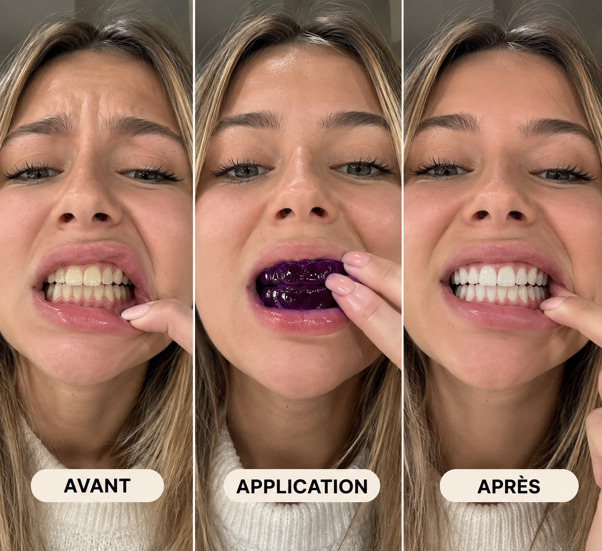 Smilevie – Soin Violet pour un Sourire Éclatant