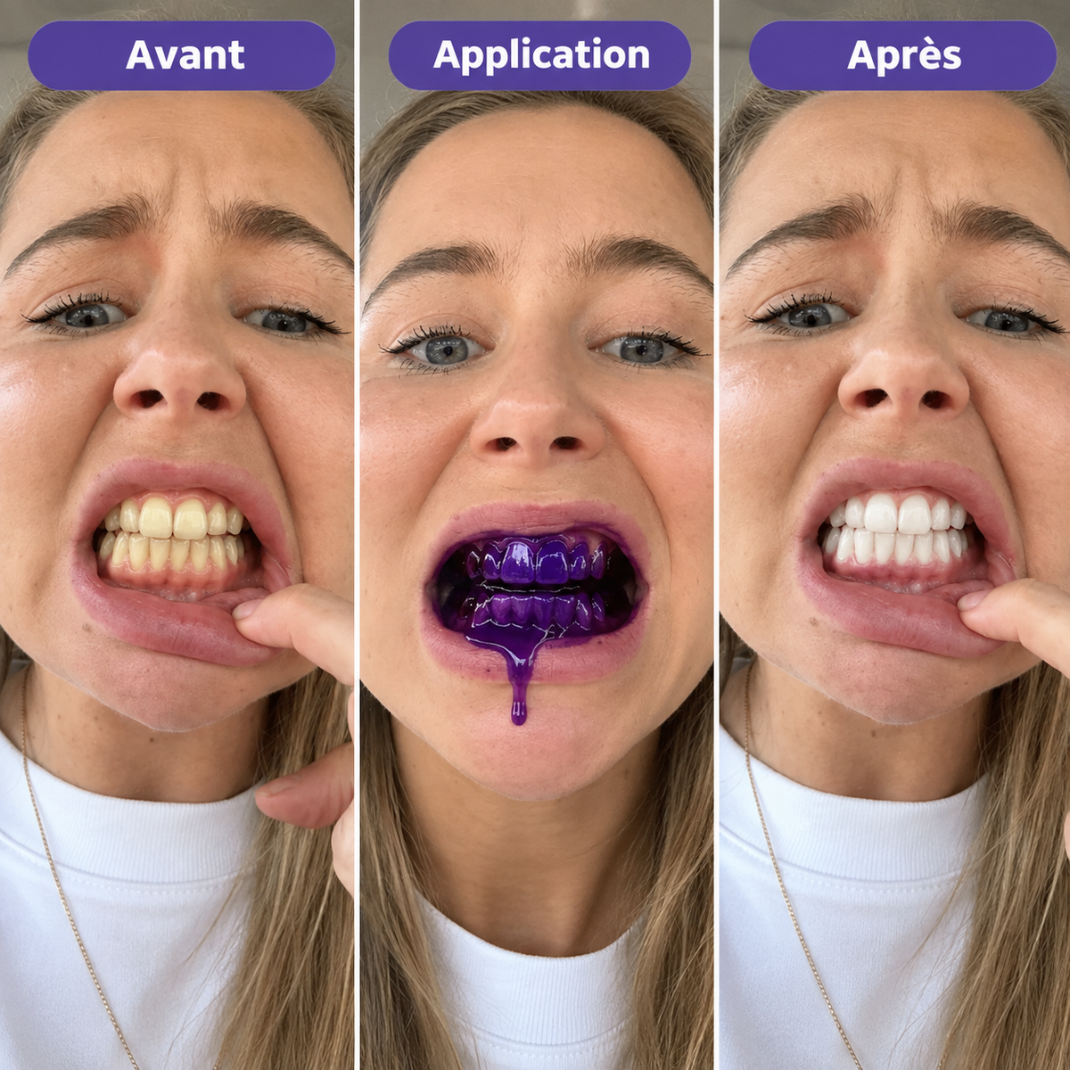 Smilevie – Soin Violet pour un Sourire Éclatant